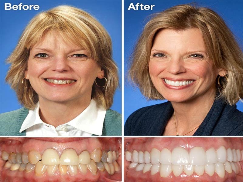 Cosmetic Dentistry
