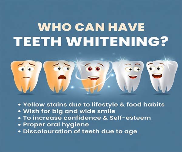 Teeth Whitening Candidate